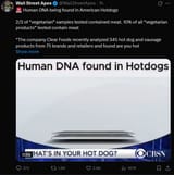 hot dogs