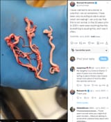 calamari-clots