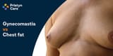 gynecomastia-vs-chest-fat_