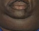 fat black guy