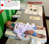 dad mocking son getting circumcised