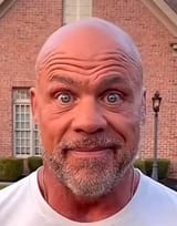 Bald_Guy_Staring