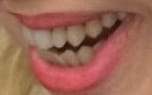 demonic fangs