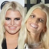 Before-After-Ozempic