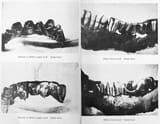 Adolf_Hitler&#039;s_dental_remains