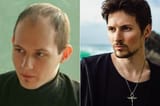 hair_transplantation_1-750x497-3954798954