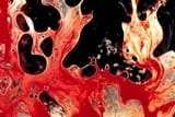 Bloody_semen