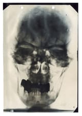 Hitler&#039;s head x ray