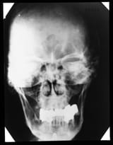 hd1-99101767-2018-003-ac