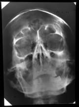 hd1-99101767-2018-001-ac