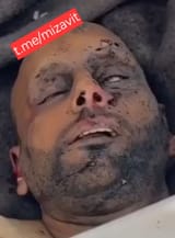 Crispy inbred Gaza terrorist