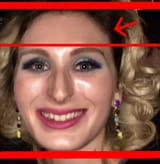 laura-loomer-nose-job6