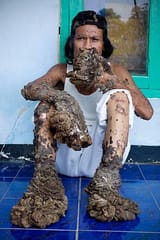 bandung-west-java-indonesia-indonesian-man-dede-koswara-sits-outside-his-home-on-december-18