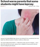 Southern California Leprosy in school _