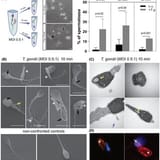 Human-spermatozoa-confronted-with-Toxoplasma-gondii-tachyzoites-lead-to-sperm-integrity_Q320