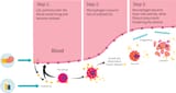 saturated-fats-LDL-artery