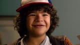 what-is-cleidocranial-dysplasia-1658869190