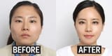 korean plastic surgery