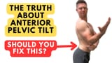 Truth about anterior pelvic tilt should you fix this