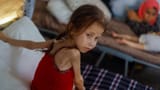 2024-06-24T134434Z_692696262_RC25G8AAZG0X_RTRMADP_3_ISRAEL-PALESTINIANS-GAZA-MALNUTRITION (2)