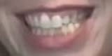 chosensmile