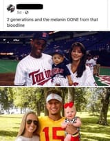 melanin gone