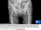 pork_parasite_hips