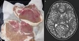 pork_brain_parasites
