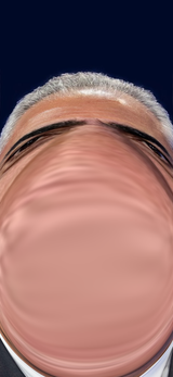 nose2