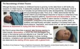 neurobiology of infant trauma circumcision