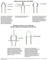 original circumcision vs modern