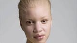 black_person_with_white_skin