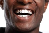 americanteeth
