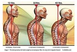 tech-neck