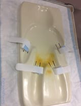 1742483069093562 circumcision