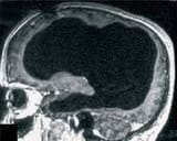 brainscan