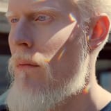 1Albino God eye