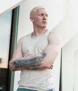 Albino European male 3