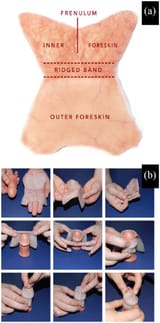 The-human-foreskin-shape-after-surgical-removal-a-schematic-representation-of-human