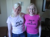 Albino Indian women Albino European