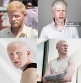 Albino Indian with three Albino Europeans
