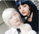 Albino European female Russia