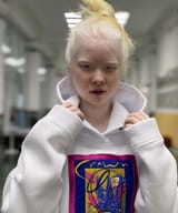 Albino Asian women