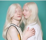 Albino European teens