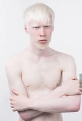 Albino European male 4.1