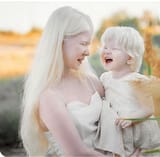 Albino Kazkhstani Female and child (sisters)