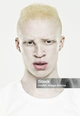 Albino African 1