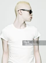 Albino African male 2