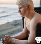 Albino thinker