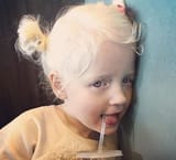 Albino European girl